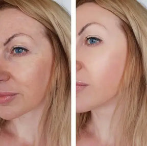 Crème magique FaceSlift® - dissimule 100% des imperfections et élimine les taches et les rides
